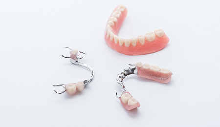 Implant Consultation